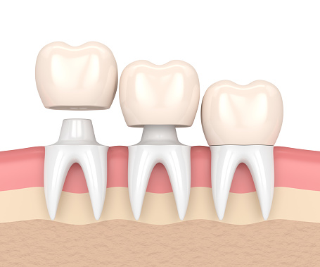 Professional and effective restorative dentistry options from New York, NY 
